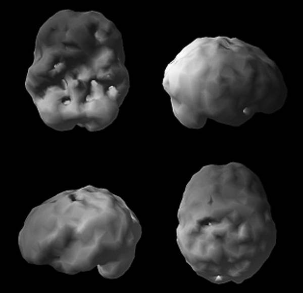 Иллюстрация к книге — Измени свой мозг - изменится и возраст! [i_074.jpg]