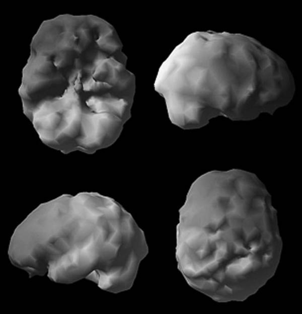 Иллюстрация к книге — Измени свой мозг - изменится и возраст! [i_081.jpg]