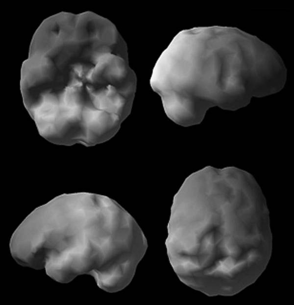 Иллюстрация к книге — Измени свой мозг - изменится и возраст! [i_082.jpg]