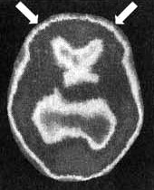 Иллюстрация к книге — Измените свой мозг - изменится и жизнь! [i_001.jpg]