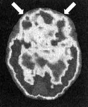 Иллюстрация к книге — Измените свой мозг - изменится и жизнь! [i_002.jpg]