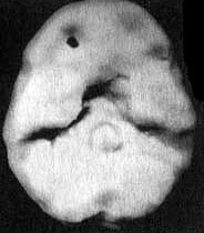 Иллюстрация к книге — Измените свой мозг - изменится и жизнь! [i_003.jpg]