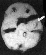 Иллюстрация к книге — Измените свой мозг - изменится и жизнь! [i_004.jpg]