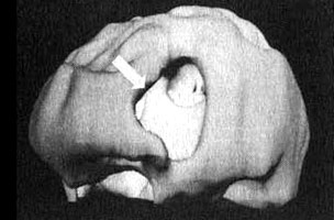 Иллюстрация к книге — Измените свой мозг - изменится и жизнь! [i_013.jpg]