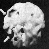 Иллюстрация к книге — Измените свой мозг - изменится и жизнь! [i_014.jpg]