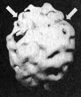 Иллюстрация к книге — Измените свой мозг - изменится и жизнь! [i_016.jpg]