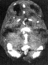 Иллюстрация к книге — Измените свой мозг - изменится и жизнь! [i_018.jpg]