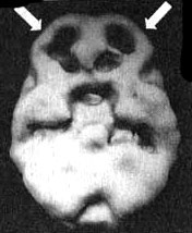 Иллюстрация к книге — Измените свой мозг - изменится и жизнь! [i_027.jpg]