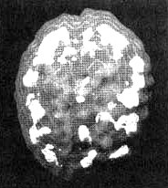 Иллюстрация к книге — Измените свой мозг - изменится и жизнь! [i_033.jpg]