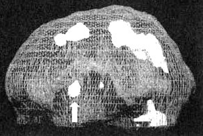 Иллюстрация к книге — Измените свой мозг - изменится и жизнь! [i_035.jpg]