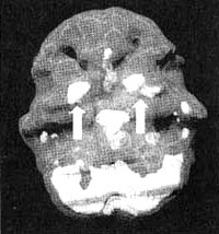 Иллюстрация к книге — Измените свой мозг - изменится и жизнь! [i_036.jpg]