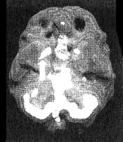 Иллюстрация к книге — Измените свой мозг - изменится и жизнь! [i_039.jpg]