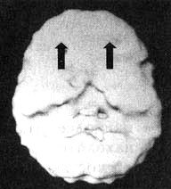 Иллюстрация к книге — Измените свой мозг - изменится и жизнь! [i_045.jpg]