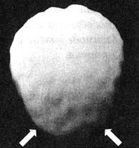 Иллюстрация к книге — Измените свой мозг - изменится и жизнь! [i_046.jpg]