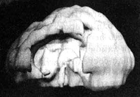 Иллюстрация к книге — Измените свой мозг - изменится и жизнь! [i_047.jpg]