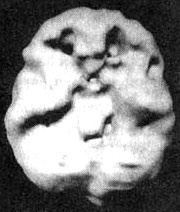 Иллюстрация к книге — Измените свой мозг - изменится и жизнь! [i_049.jpg]