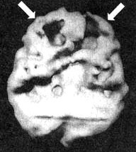 Иллюстрация к книге — Измените свой мозг - изменится и жизнь! [i_050.jpg]