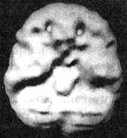 Иллюстрация к книге — Измените свой мозг - изменится и жизнь! [i_051.jpg]