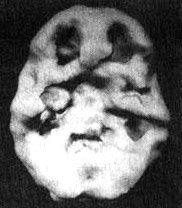 Иллюстрация к книге — Измените свой мозг - изменится и жизнь! [i_053.jpg]