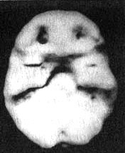 Иллюстрация к книге — Измените свой мозг - изменится и жизнь! [i_054.jpg]