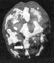 Иллюстрация к книге — Измените свой мозг - изменится и жизнь! [i_061.jpg]