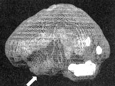 Иллюстрация к книге — Измените свой мозг - изменится и жизнь! [i_072.jpg]