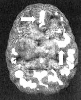 Иллюстрация к книге — Измените свой мозг - изменится и жизнь! [i_080.jpg]