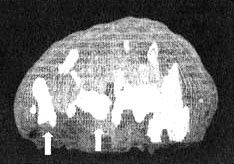 Иллюстрация к книге — Измените свой мозг - изменится и жизнь! [i_081.jpg]