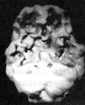 Иллюстрация к книге — Измените свой мозг - изменится и жизнь! [i_092.jpg]