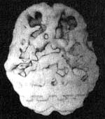 Иллюстрация к книге — Измените свой мозг - изменится и жизнь! [i_098.jpg]