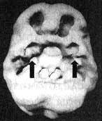 Иллюстрация к книге — Измените свой мозг - изменится и жизнь! [i_099.jpg]