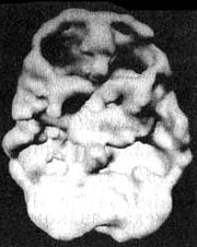 Иллюстрация к книге — Измените свой мозг - изменится и жизнь! [i_101.jpg]