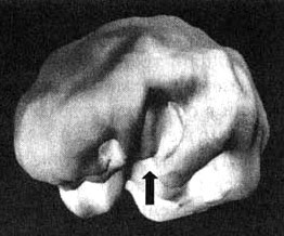 Иллюстрация к книге — Измените свой мозг - изменится и жизнь! [i_102.jpg]