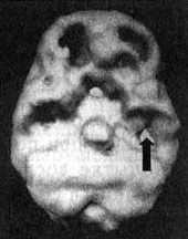 Иллюстрация к книге — Измените свой мозг - изменится и жизнь! [i_103.jpg]