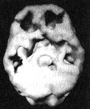 Иллюстрация к книге — Измените свой мозг - изменится и жизнь! [i_111.jpg]