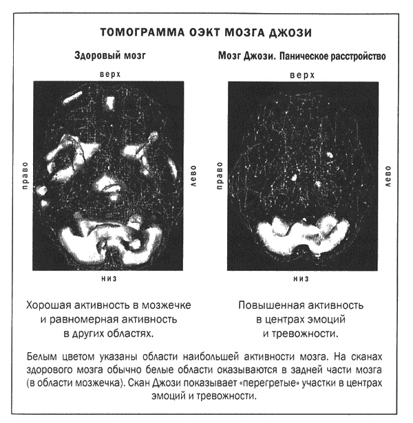Иллюстрация к книге — Мозг и душа. Новые открытия о влиянии мозга на характер, чувства, эмоции [i_001.jpg]