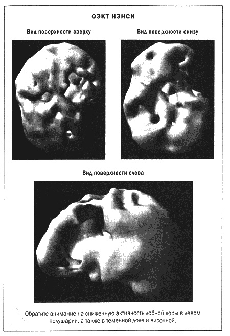 Иллюстрация к книге — Мозг и душа. Новые открытия о влиянии мозга на характер, чувства, эмоции [i_021.jpg]
