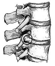 Иллюстрация к книге — Жизнь без боли в пояснице [i_008.jpg]