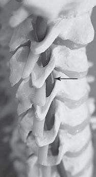 Иллюстрация к книге — Остеохондроз для профессионального пациента [i_014.jpg]