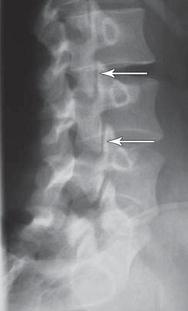 Иллюстрация к книге — Остеохондроз для профессионального пациента [i_026.jpg]