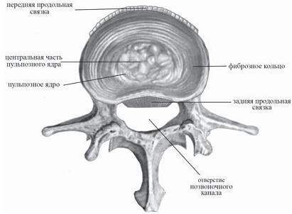 Иллюстрация к книге — Остеохондроз для профессионального пациента [i_030.jpg]
