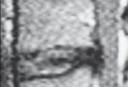 Иллюстрация к книге — Остеохондроз для профессионального пациента [i_037.jpg]