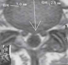 Иллюстрация к книге — Остеохондроз для профессионального пациента [i_044.jpg]