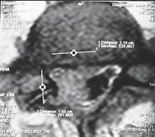 Иллюстрация к книге — Остеохондроз для профессионального пациента [i_045.jpg]