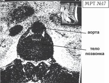 Иллюстрация к книге — Остеохондроз для профессионального пациента [i_049.jpg]