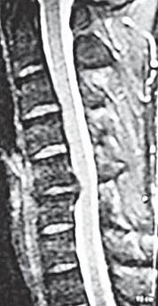 Иллюстрация к книге — Остеохондроз для профессионального пациента [i_051.jpg]