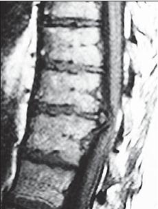 Иллюстрация к книге — Остеохондроз для профессионального пациента [i_055.jpg]