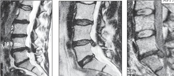 Иллюстрация к книге — Остеохондроз для профессионального пациента [i_058.jpg]