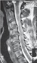 Иллюстрация к книге — Остеохондроз для профессионального пациента [i_061.jpg]