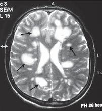 Иллюстрация к книге — Остеохондроз для профессионального пациента [i_062.jpg]